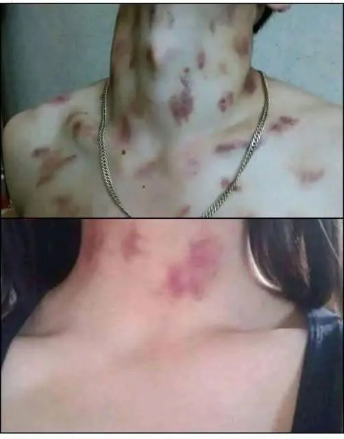X If your partner makes you these chu… See more