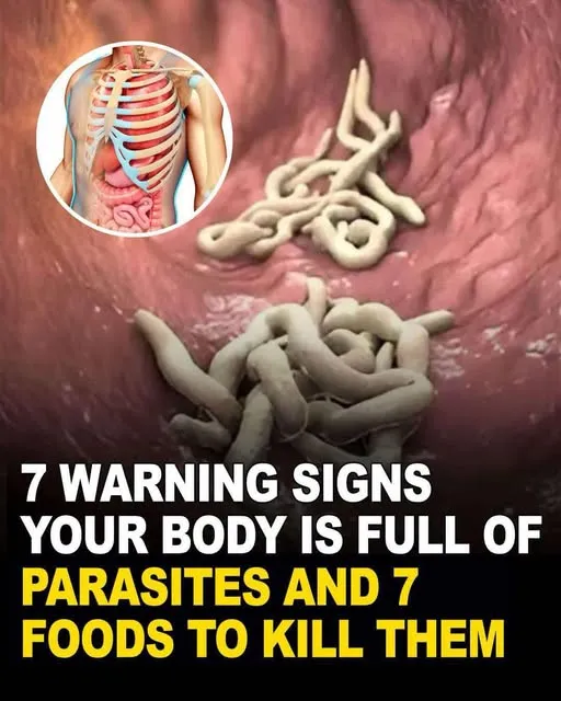 7 warning signs your body is full of parasites...